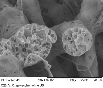 Highly porous fibers for cell cultivation and drug delivery. Photos: DITF